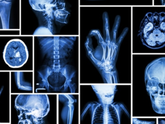 تقنية الأشعة السينية والمستقبل المحتمل للتشخيص الطبي